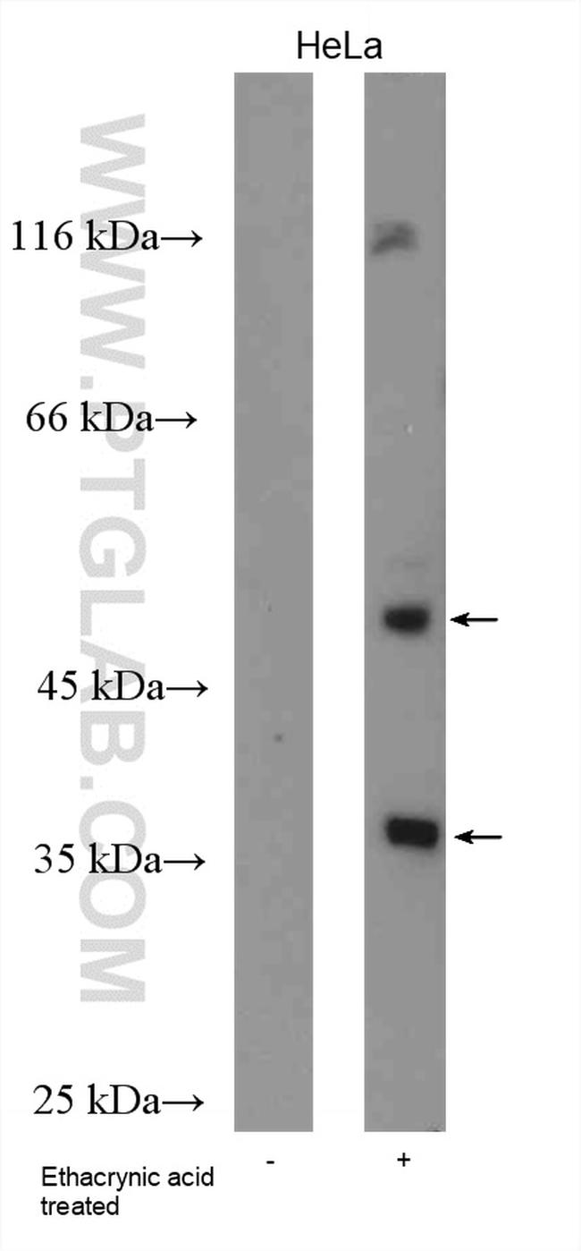 Phospho Tdp Ser Ser Antibody Ap