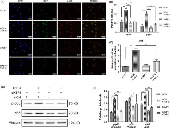 XBP1 Antibody MA5 15768