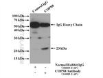COPS8/COP9 Antibody in Immunoprecipitation (IP)