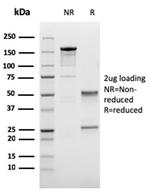 Cadherin 17/LI Cadherin (Liver-Intestine Marker) Antibody in SDS-PAGE (SDS-PAGE)