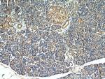 Ubiquitin Antibody in Immunohistochemistry (Paraffin) (IHC (P))