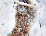 Sam68 Antibody in Immunohistochemistry (Paraffin) (IHC (P))