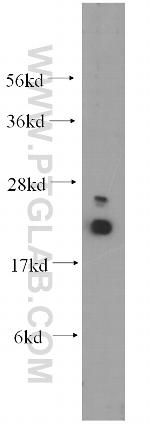 UBC9 Antibody in Western Blot (WB)