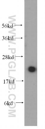 UBC9 Antibody in Western Blot (WB)