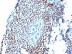 p21WAF1 (Tumor Suppressor Protein) Antibody in Immunohistochemistry (Paraffin) (IHC (P))