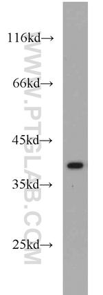 IkB alpha Antibody in Western Blot (WB)