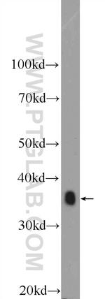 IkB alpha Antibody in Western Blot (WB)