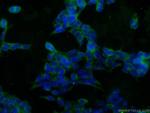 SOD1 Antibody in Immunocytochemistry (ICC/IF)