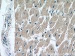 SOD1 Antibody in Immunohistochemistry (Paraffin) (IHC (P))