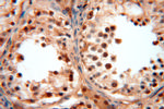 SOD1 Antibody in Immunohistochemistry (Paraffin) (IHC (P))