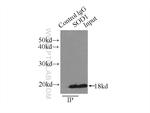 SOD1 Antibody in Immunoprecipitation (IP)