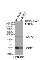 SOD1 Antibody in Western Blot (WB)