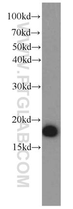 SOD1 Antibody in Western Blot (WB)