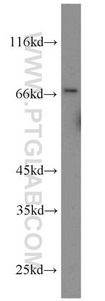 uPAR Antibody in Western Blot (WB)