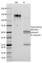 p14ARF Antibody in SDS-PAGE (SDS-PAGE)