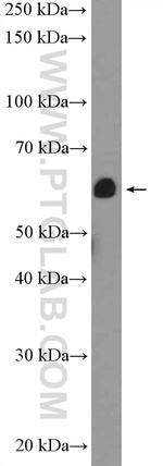 calreticulin Antibody in Western Blot (WB)