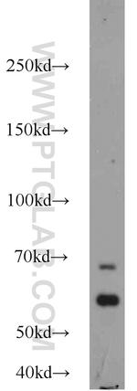 calreticulin Antibody in Western Blot (WB)