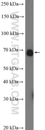 calreticulin Antibody in Western Blot (WB)