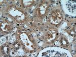 P21 Antibody in Immunohistochemistry (Paraffin) (IHC (P))