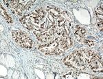 P21 Antibody in Immunohistochemistry (Paraffin) (IHC (P))