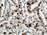 P21 Antibody in Immunohistochemistry (Paraffin) (IHC (P))