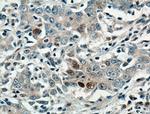 P21 Antibody in Immunohistochemistry (Paraffin) (IHC (P))