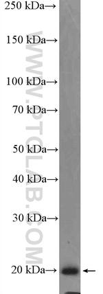 P21 Antibody in Western Blot (WB)