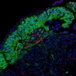 P21 Antibody in Immunocytochemistry (ICC/IF)