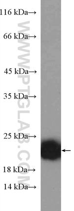 P21 Antibody in Western Blot (WB)