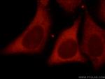 MMP1 Antibody in Immunocytochemistry (ICC/IF)