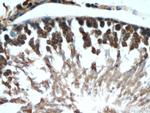 MMP1 Antibody in Immunohistochemistry (Paraffin) (IHC (P))