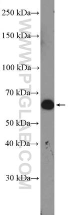 RAP1GDS1 Antibody in Western Blot (WB)