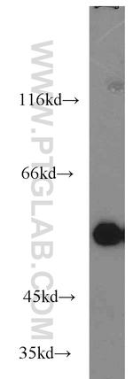 P53 Antibody in Western Blot (WB)