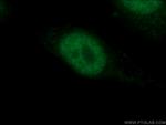 P53 Antibody in Immunocytochemistry (ICC/IF)