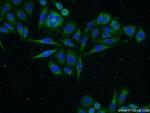 GADD34 Antibody in Immunocytochemistry (ICC/IF)