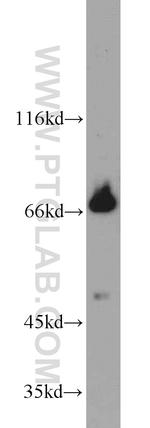 CLINT1 Antibody in Western Blot (WB)