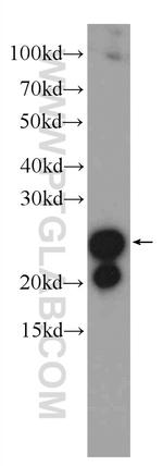 transgelin/SM22 Antibody in Western Blot (WB)
