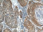 KEAP1 Antibody in Immunohistochemistry (Paraffin) (IHC (P))