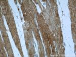 KEAP1 Antibody in Immunohistochemistry (Paraffin) (IHC (P))