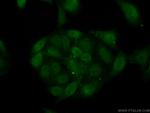 CSNK2A2 Antibody in Immunocytochemistry (ICC/IF)