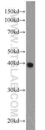 CSNK2A2 Antibody in Western Blot (WB)