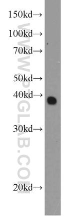 CSNK2A2 Antibody in Western Blot (WB)