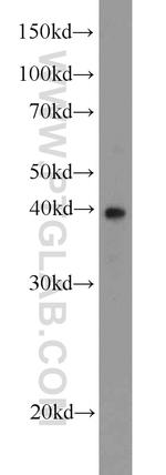 CSNK2A2 Antibody in Western Blot (WB)