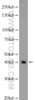 CSNK2A2 Antibody in Western Blot (WB)