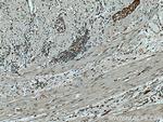 FASN Antibody in Immunohistochemistry (Paraffin) (IHC (P))