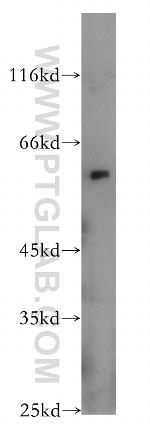 AHCYL1 Antibody in Western Blot (WB)