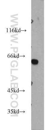 AHCYL1 Antibody in Western Blot (WB)