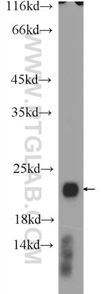 RAC2 Antibody in Western Blot (WB)