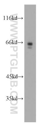 p65/RELA Antibody in Western Blot (WB)