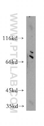 GSPT1 Antibody in Western Blot (WB)